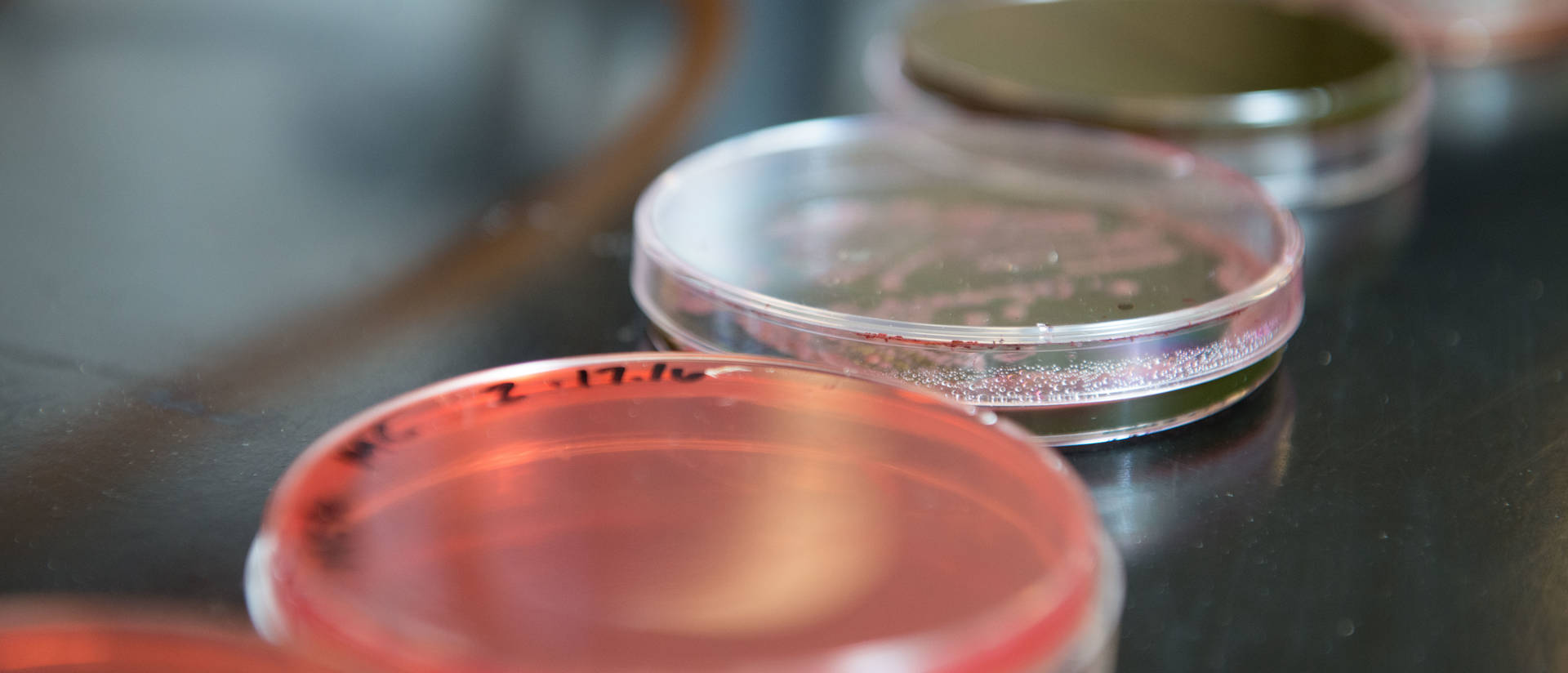 Photo of petri dishes being used in a lab